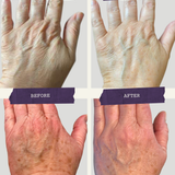 Activating Hand Serum