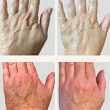 Activating Hand Serum