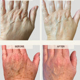 Power Pair: Activating Hand Serum + Treatment-Boosting Gloves
